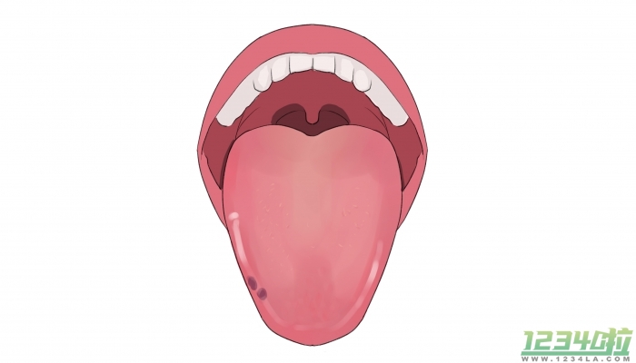 舌头两边锯齿状是什么原因 舌头两边锯齿状会自愈吗
